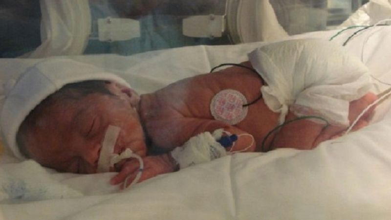 Ich dziecko zmarło tuż po urodzeniu. 10 miesięcy później fotograf robi zdjęcie, które po prostu musisz zobaczyć