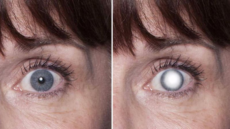 Kobieta straciła wzrok w jednym oku. Wszystko przez urządzenie, z którego na co dzień korzysta każdy