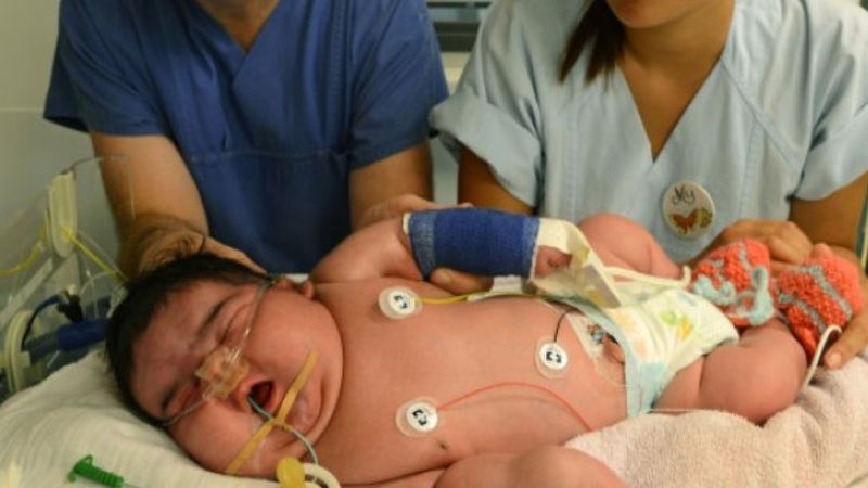 10-kilogramowy noworodek przyszedł na świat w Niemczech. To jedno z największych dzieci na świecie
