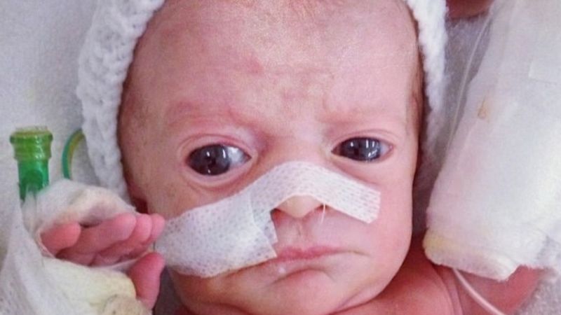 Lekarze nie mogli uwierzyć, gdy zobaczyli to dziecko. Tylko operacja mogła mu uratować życie