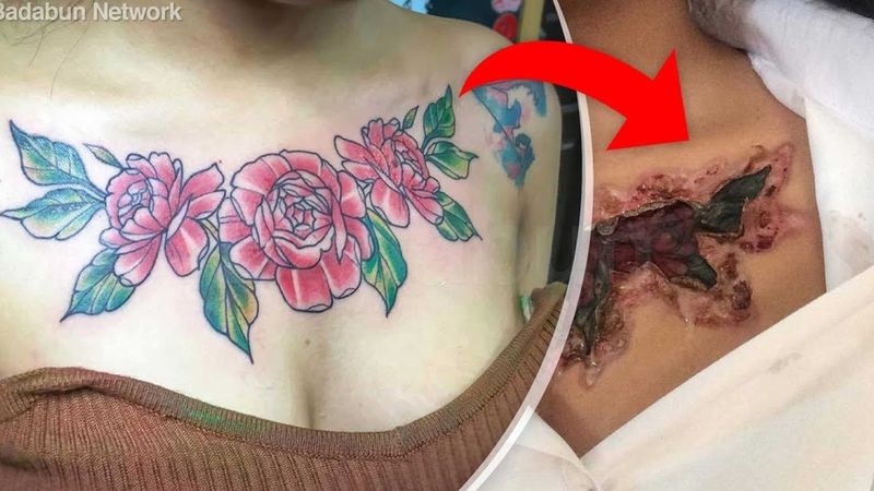 Wykonano jej tatuaż tanim tuszem. Nie uwierzysz, jak 3 miesiące później wyglądała jej skóra