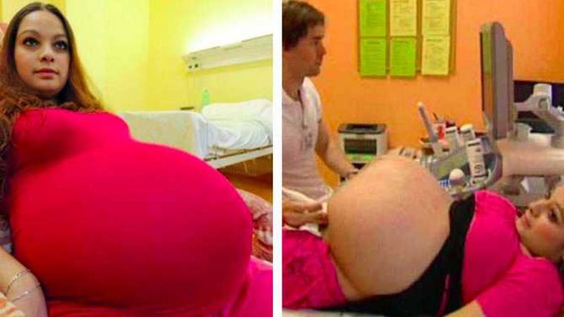 23-latka myśli, że jest w ciąży bliźniaczej. Ale kolejne badanie USG wyprowadza ją z tego błędu!