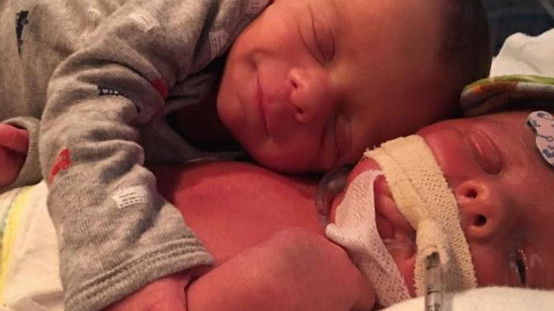 11 dniowy noworodek przytula brata bliźniaka. Niestety, wkrótce potem lekarze nie mogą mu już pomóc.