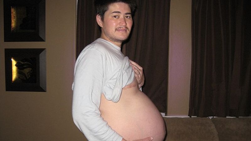 ’Mężczyzna’ zachodzi w ciążę i rodzi dziecko. Jest 1 z 5 takich osób na całym świecie