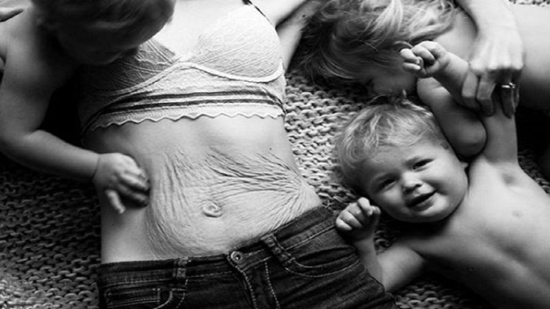 Kobiety pokazały, jak wyglądają ich brzuchy po upływie tygodni, a nawet miesięcy od porodu