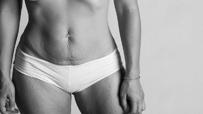 Fotografuje kobiety po porodzie, aby pokazać, jak naprawdę wyglądają ich ciała