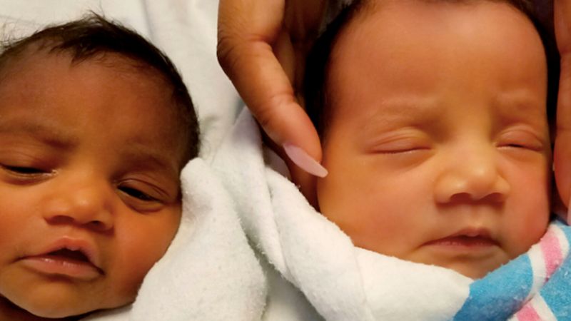Kiedy opublikowała zdjęcie córek po raz pierwszy, ludzie nie wierzyli, że są bliźniaczkami