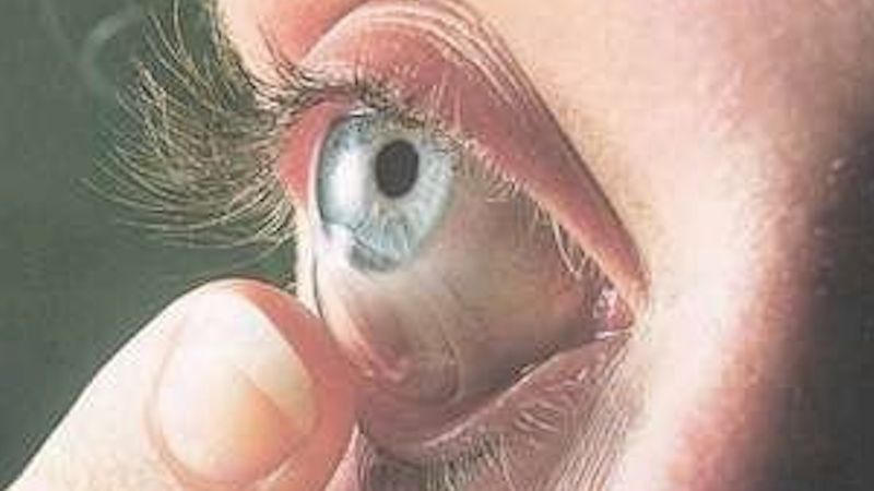 Okulista nie mógł uwierzyć w to, co znalazł w oku 65-latki. O takim przypadku nawet nie słyszał