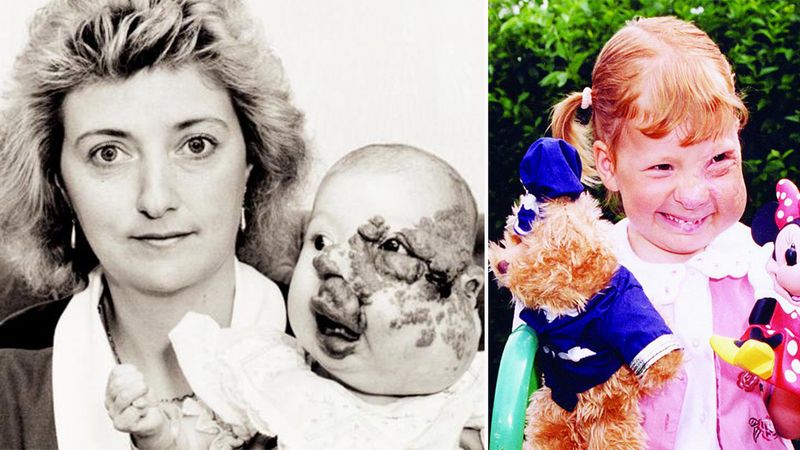 Urodziła się ze szpecącymi znamionami na twarzy. W ciągu 14 lat przeszła aż 18 operacji