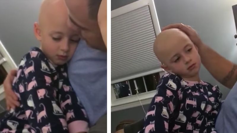 Z powodu choroby jego córka łysieje. Kochający tata robi coś, aby dziewczynka poczuła się lepiej