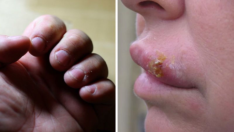 11 faktów o obgryzaniu paznokci, które powstrzymają Cię, zanim znów włożysz palce do ust