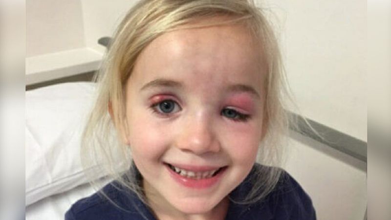 Lekarz uznał, że to infekcja oczu. Gdyby nie druga opinia specjalisty, dziewczynka mogła umrzeć