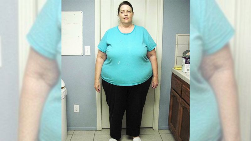 63-latka zrzuciła ponad 100 kilogramów. Teraz w niczym nie przypomina siebie sprzed lat