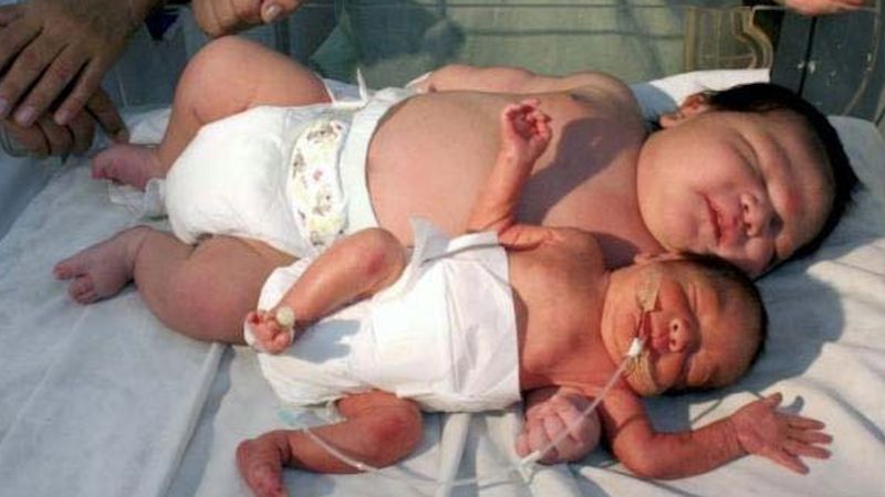 8 największych noworodków, które przyszły na świat. Niektóre urodziły się bez cesarskiego cięcia