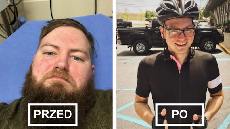12 zdjęć osób przed i po tym, jak przestały pić alkohol. Różnica jest widoczna gołym okiem