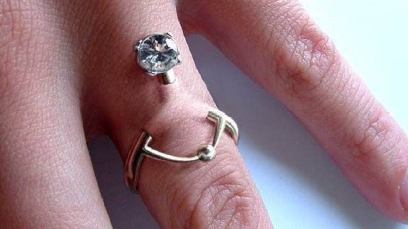 Zamiast nosić pierścionek na palcu, ludzie go ‚wszczepiają’. Wygląda to dość niepokojąco