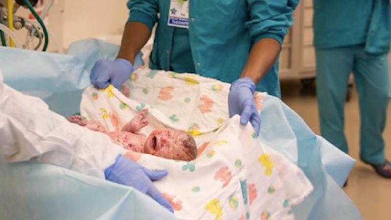 Lekarze byli zmuszeni wywołać wcześniejszy poród. Mimo to kobieta rodziła przez 4 dni