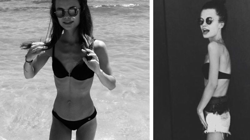 Dziewczyna polskiego projektanta ujawnia swoje zdjęcia z okresu anoreksji. Dziś są już wspomnieniem