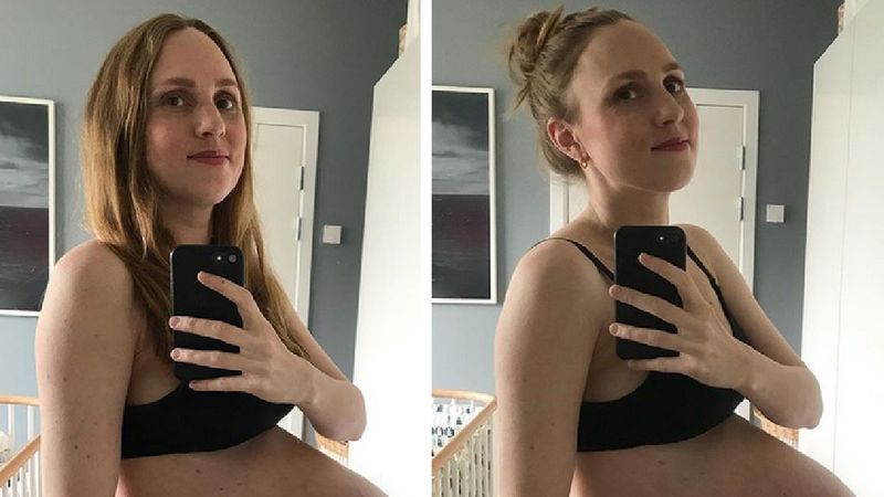 Była w ciąży z trojaczkami. Teraz pokazuje jak wygląda jej brzuch po porodzie