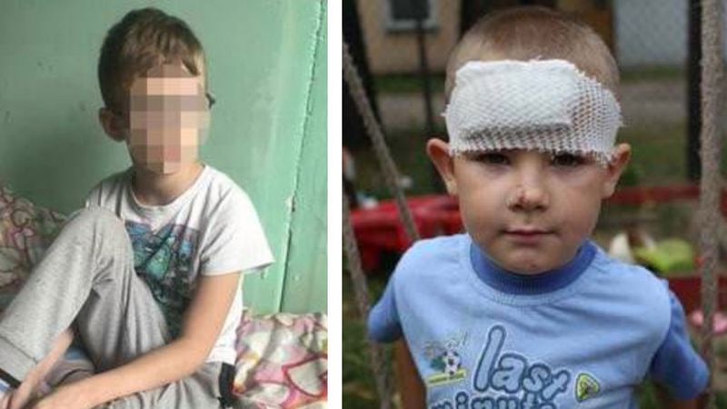 10-latek wyznał dlaczego pociął nożem twarz 5-letniego kolegi na placu zabaw