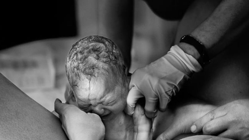 Robi zdjęcia w czasie porodu właśnie w tym momencie, gdy noworodek wychyla główkę na świat