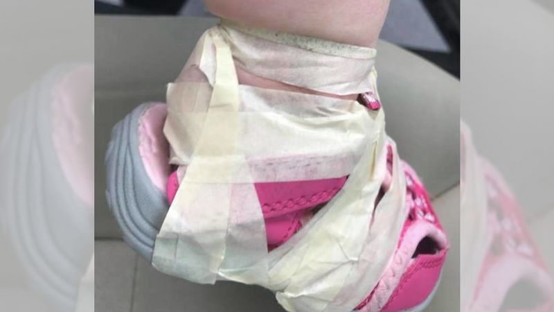 Przedszkolanki przykleiły jej do stóp buciki. 17-miesięczna dziewczynka płakała z bólu