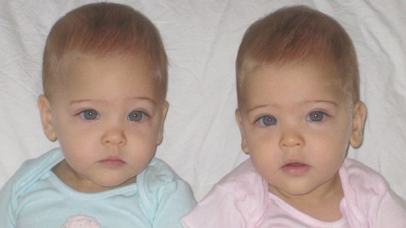 Przyszły na świat 11 lat temu. Dziś uważane są za najpiękniejsze bliźniaczki w historii