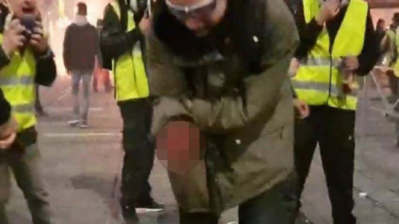 Granat urwał dłoń demonstrantowi z Francji. Nagranie z miejsca zdarzenia wstrząsnęło światem