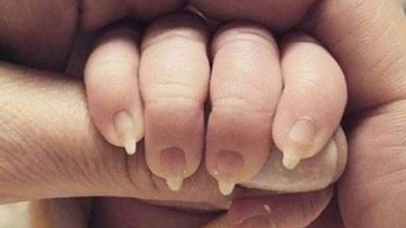 Zamiast obciąć noworodkowi paznokcie, wypiłowała je. 4 absurdalne zachowania rodziców