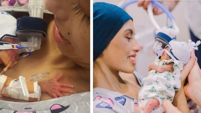 19-latka w ciąży zachorowała na białaczkę. Odwlekała leczenie, aby uratować synka