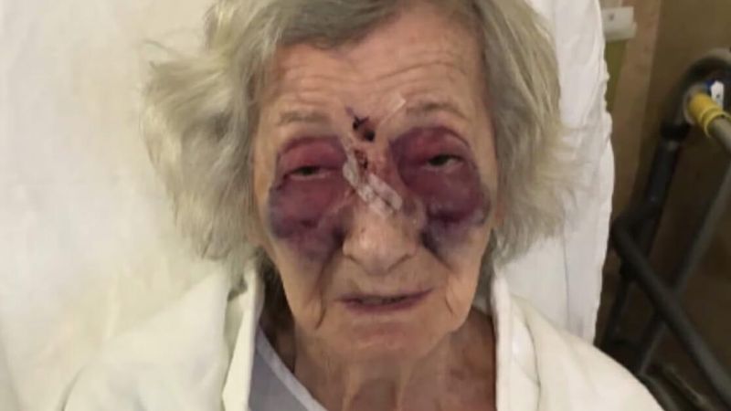 92-latka, która przeżyła Holokaust został pobita w taksówce. „Krew wypływała mi z nosa”