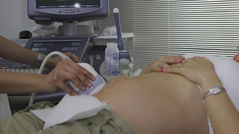 To miało być rutynowe badanie USG w 24. tygodniu ciąży. Lekarz nie odrywał wzroku od ekranu