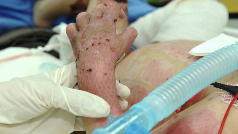 Horror niemowlęcia z Katowic. Trafił do szpitala z obrażeniami ciała i połamanymi żebrami