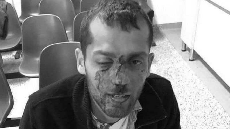 Studenci z Izraela brutalnie pobici w Warszawie. Napastnicy krzyczeli „Jeb… Izrael”