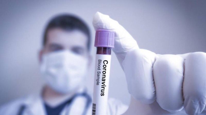 X nowych przypadków zakażeń koronawirusem