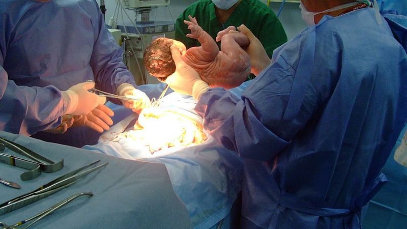 Tuż po porodzie, zamiast pierwszego płaczu córeczki, usłyszała śmiech lekarza…