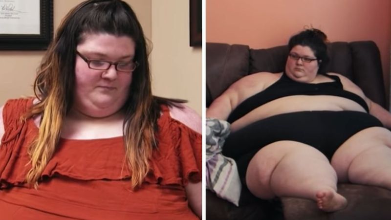 Kobieta ważyła 291 kilogramów. Zmarła po operacji zmniejszania żołądka
