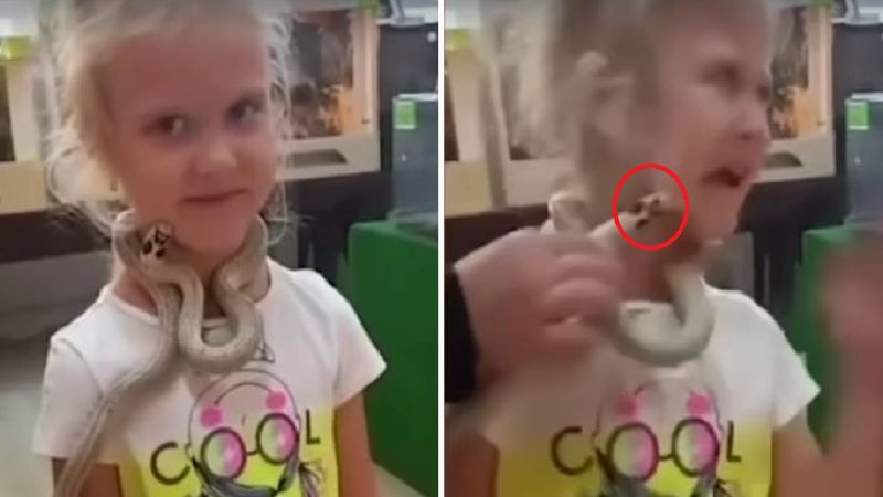 5-latka ugryziona przez węża