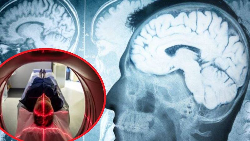 Tajemnicza choroba atakuje mózg. Czy to znowu patogen uwolniony z laboratorium?