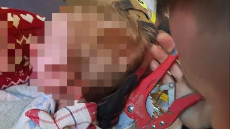 Głowa dziecka utknęła w desce sedesowej
