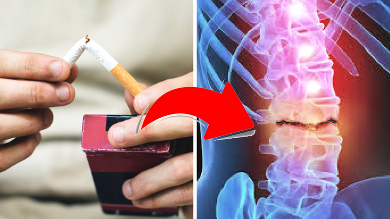 Nawyki powodujące ból pleców. Palenie papierosów jest jednym z nich!
