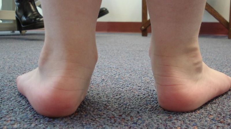 5 najczęstszych problemów z nogami u dzieci. Czy jako rodzic masz się czym martwic?