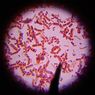 Nanomagnesy, które zawdzięczamy bakteriom glebowym...