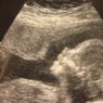 Modyfikacje genetyczne w służbie ekologii. Pomysły szalonego bioetyka?