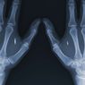 Nosiciele HIV w Indonezji będą "tagowani" chipami RFID?