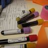 Błyskawiczny test do wykrywania wirusów Ebola