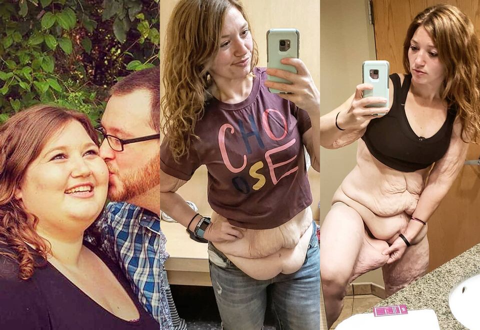 2"Gruba dziewczyna ma dość" 28-latka schudła 122 kilogramy