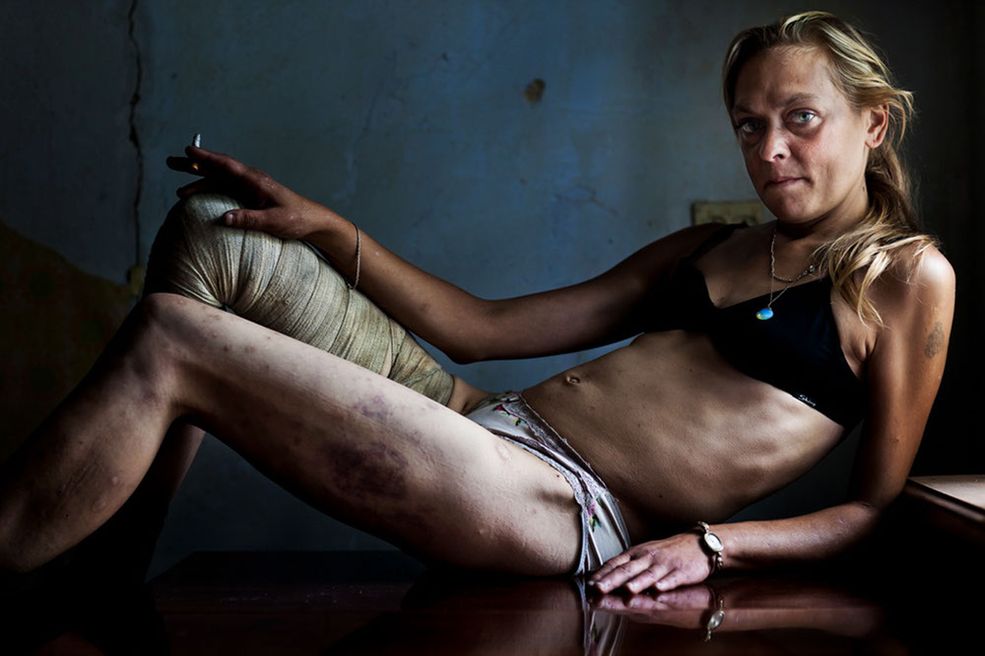 1. miejsce, "Problemy współczesności" - zdjęcia pojedyncze © Brent Stirton, Południowa Afryka, Getty Images dla "Kiev Independent". Maria, prostytutka i narkomanka, przyjmuje klientów w mieście Krzywy Róg. Kobieta ma na utrzymaniu 9-letnią córkę. Ukraina, 31 sierpnia 2011 r.