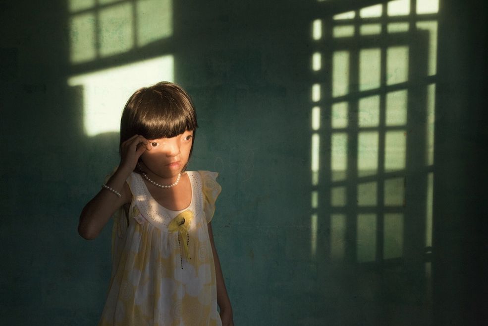 Fot. Ed Kashi / VII Photo Agency / USA 2nd Prize Contemporary Issues Single
Ed Kashi, USA, VII Photo Agency
Nguyen Thi Ly, 9, suffers from Agent Orange disabilities, Da Nang, Vietnam