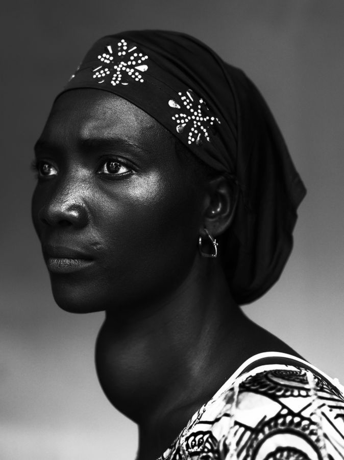 People – Staged Portraits Stories - 1 miejsce Stephan Vanfleteren sfotografował Makone Soumaoro, pacjentkę statku-szpitala African Mercy w stolicy Gwinei, Conakry. Republika Gwinei jest jednym z najuboższych krajów świata, a większość mieszkańców nie ma dostępu do opieki miedycznej.